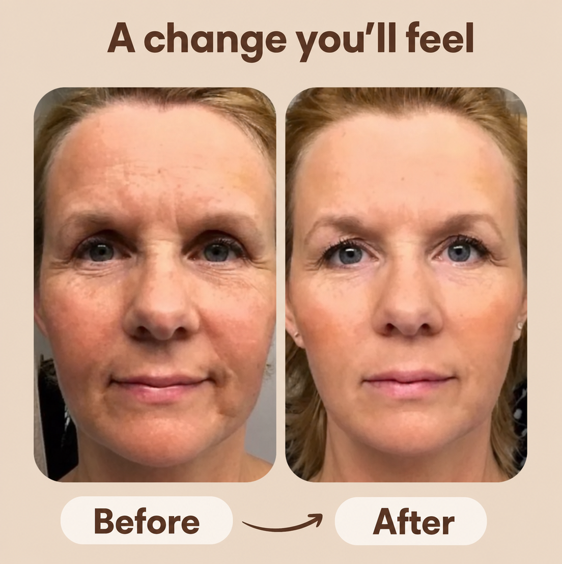 Evolux Lymphatic Brush