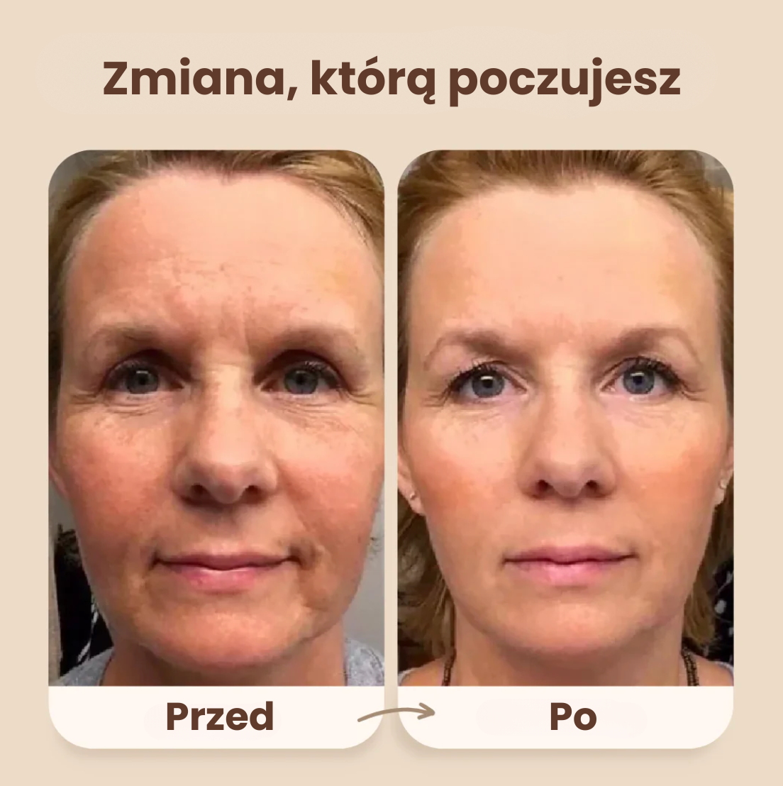 Evolux™ Szczotka Liftingująca