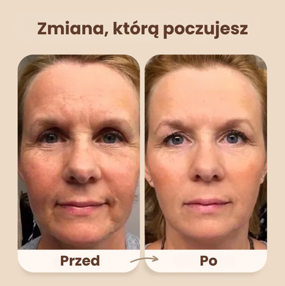 Evolux™ Szczotka Liftingująca