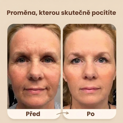 Evolux™ Liftingový kartáč