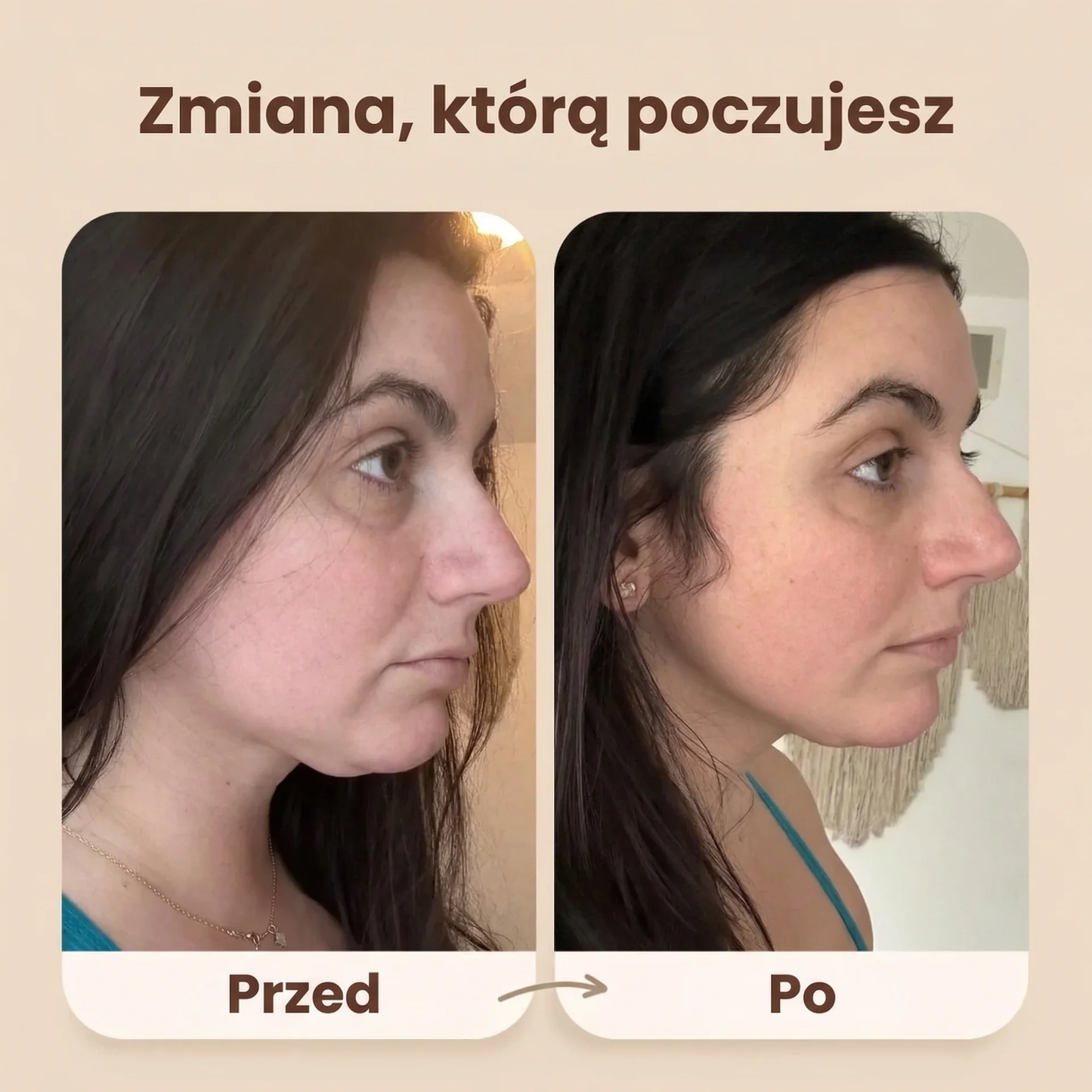 Skult Opaska Liftingująca