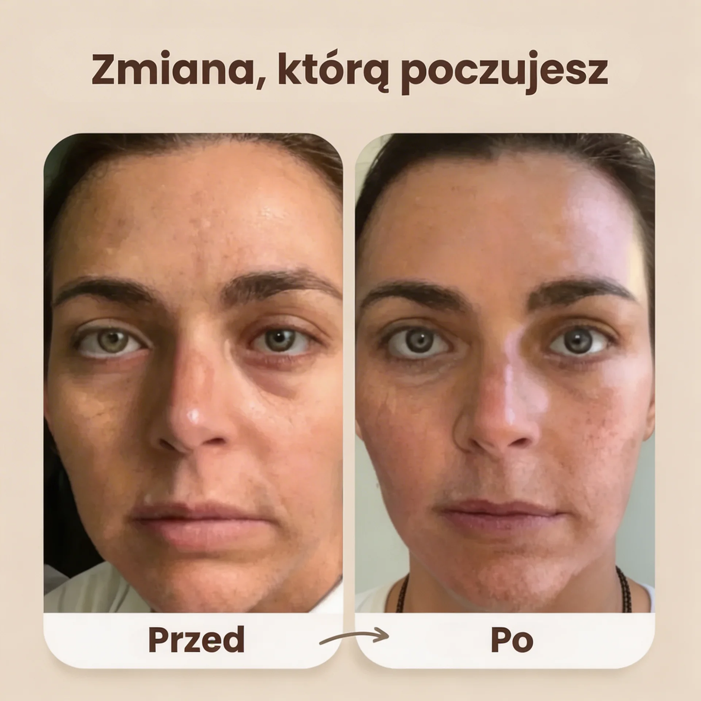 Evolux™ Szczotka Liftingująca