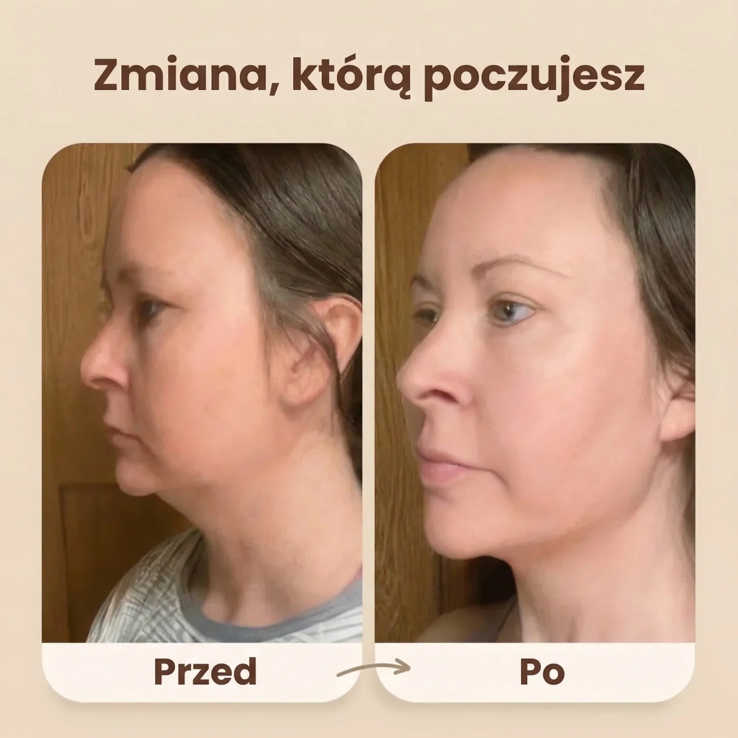 Evolux™ Szczotka Liftingująca