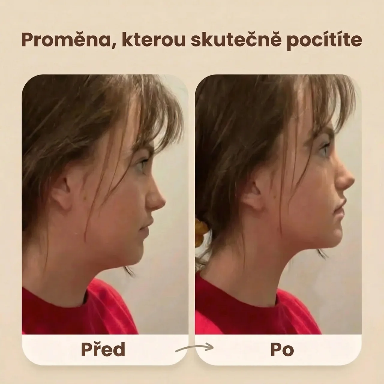 Evolux™ Liftingový kartáč