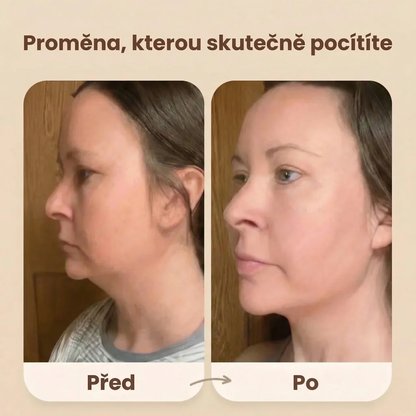 Evolux™ Liftingový kartáč